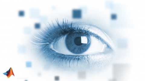 Digital Image Processing Using Matlab